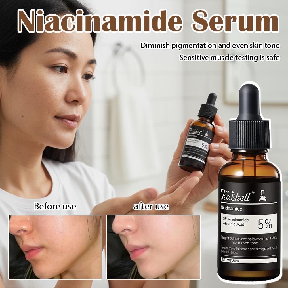 Alpha Arbutin Serum - 30ml Niacinamid Aufhellendes Serum Alpha Arbutin