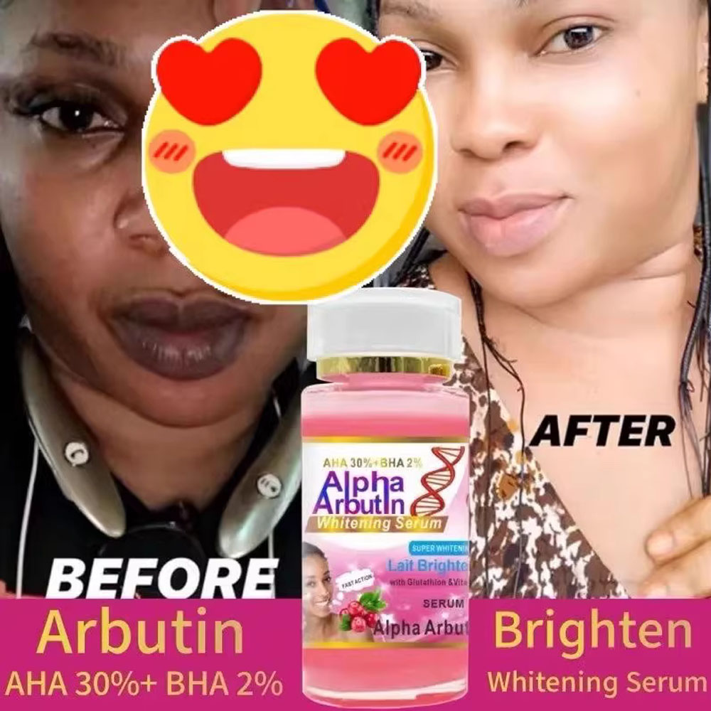 Alpha Arbutin Serum AHA 30 %+  – Alpha Arbutin Serum Bewertung und Preis