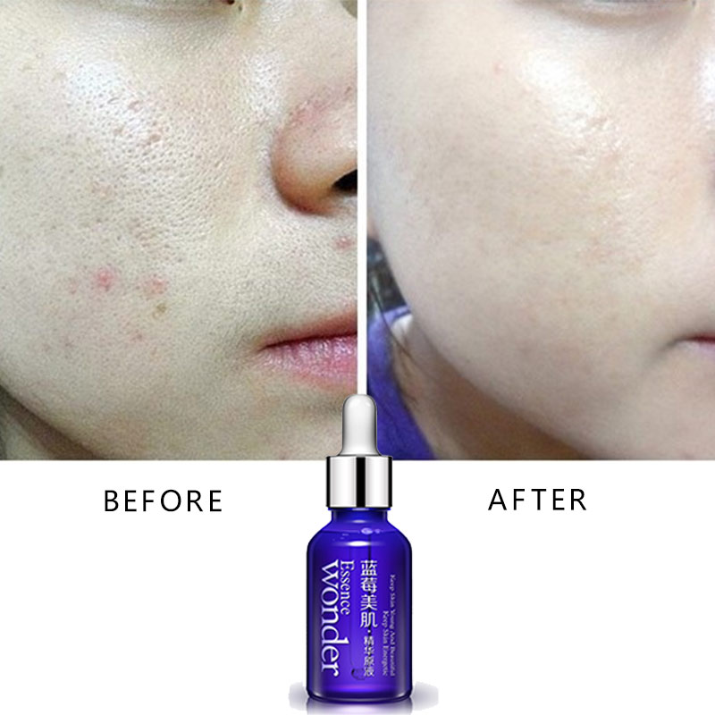 BIOAQUA Heidelbeere Gesicht Li – Skincare Bioaqua Bewertung und Preis